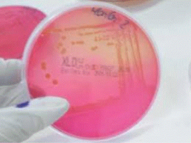 USO DE INDICADORES DE PH EN LOS MEDIOS DE CULTIVO