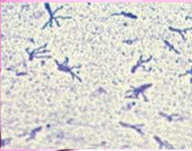 FLAGELOS BACTERIANOS