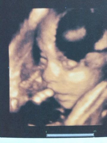 PRIMERA FOTICO DEMI HIJO MARTIN