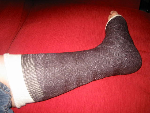 I break my ankle