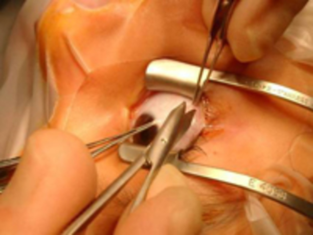 Programarón mi operación