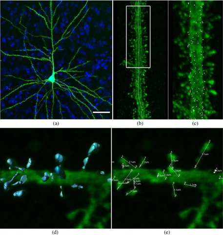 Representación musical de la morfología de las neuronas