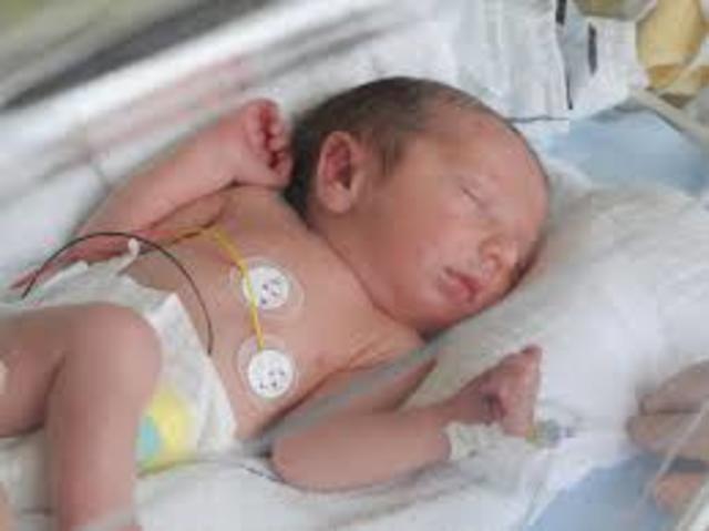 primeros dias de nacer