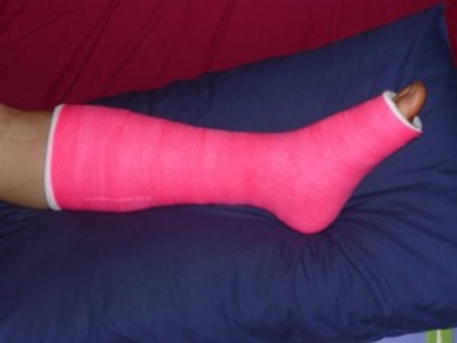 When i twisted my ankle