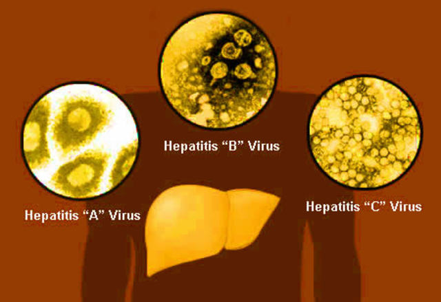 Hepatitis A and B Discovered