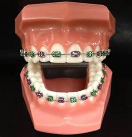 J'ai prendu mon bagues