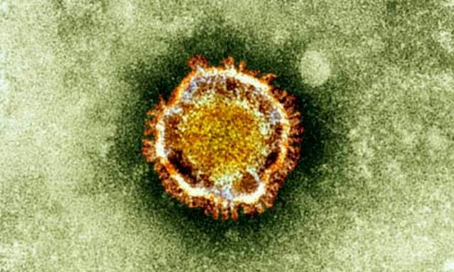 Identified virus as corona virus which had jumped species