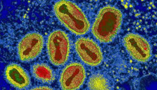 Routine Smallpox Vaccination Discontinued in U.S.