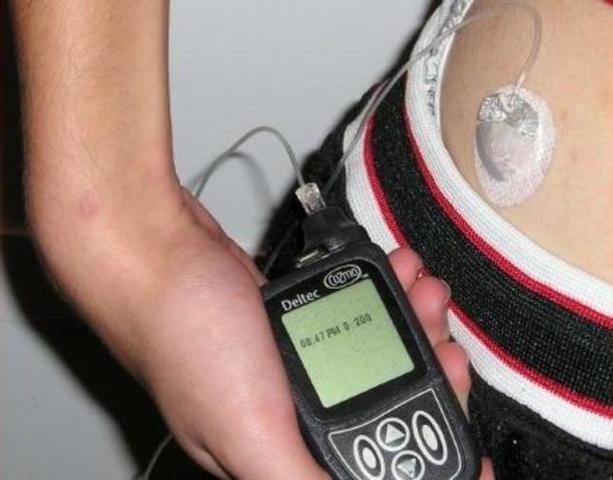 Páncreas artificial