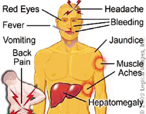 Yellow Fever Vaccine