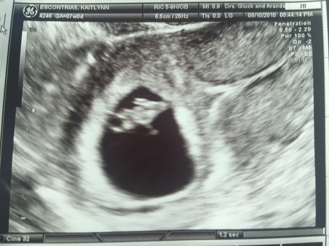 Found out I was Pregnant