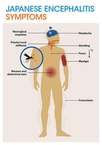 Japanese Encephalitis Vaccine