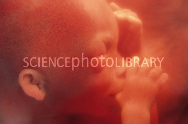 Second month of pregnancy