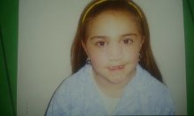 Me fracture la nariz