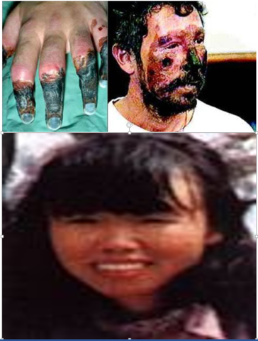 Yasuko Namba and Beck Weathers