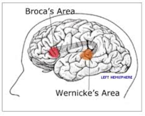 Wernicke y Broca