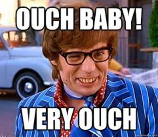 Broke my arm in class