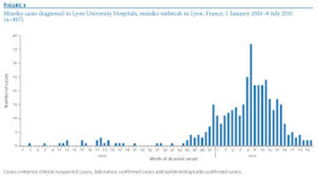 Measles  Outbreak in France
