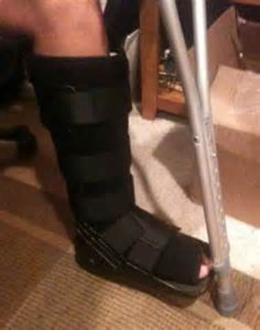 Broke my foot