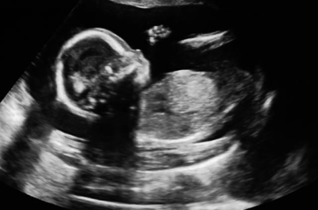 7 Months In Mommy Tummy