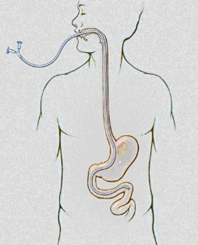 Alimentación oroyeyunal