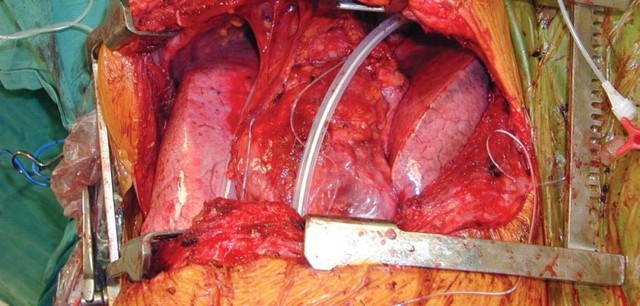 ολοκλήρωση των ομαδικών ημερολογίων