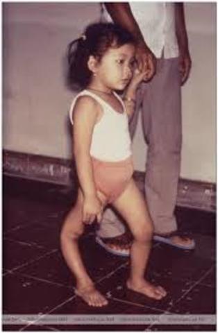 VACUNA CONTRA LA POLIOMIELITIS