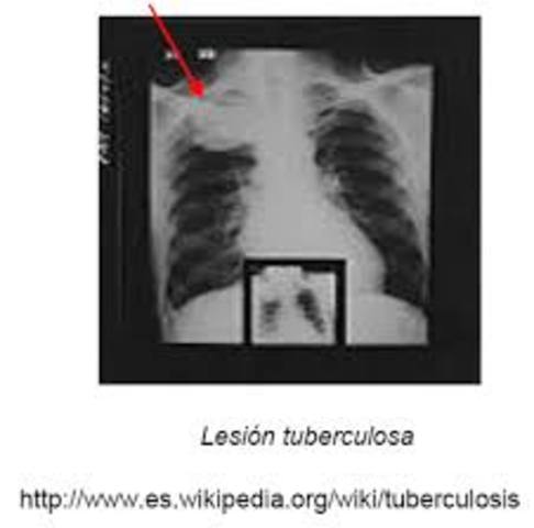 RADIOGRAFIA DE TORAX