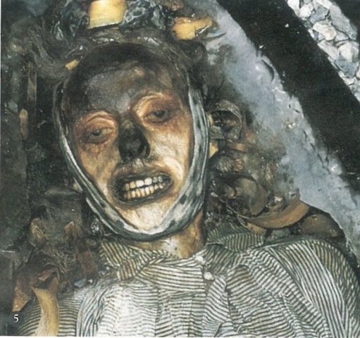 John Torrington died