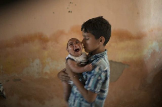 Zika e a microcefalia