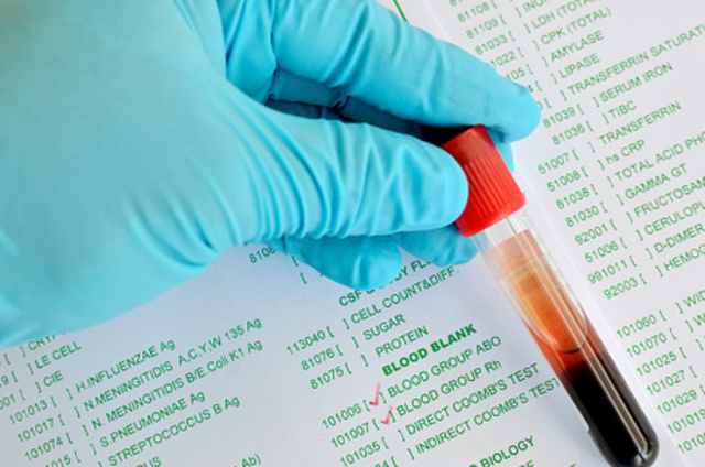 O primeiro contato do vírus em humanos