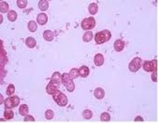 Haemophilus influenzae