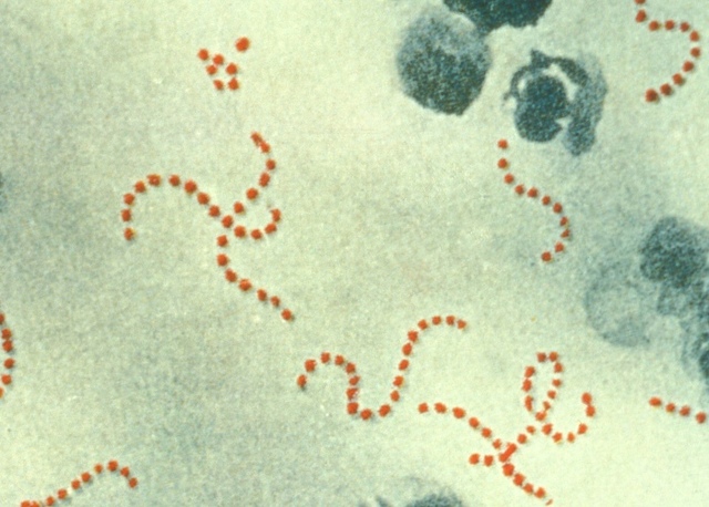 Sub-Division of Streptococcus