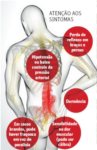 Síndrome de Guillain-Barré