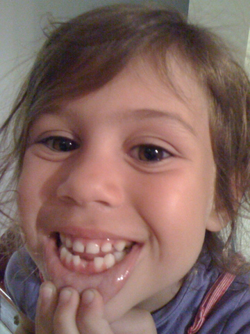 Lost my first tooth at camping.