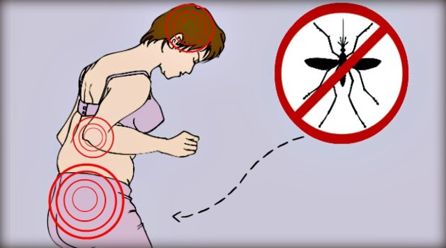 Síndrome de Guillain-Barré atualmente