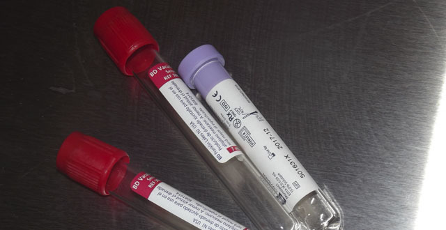 Aumento de contrato en el Centro de Transacciones