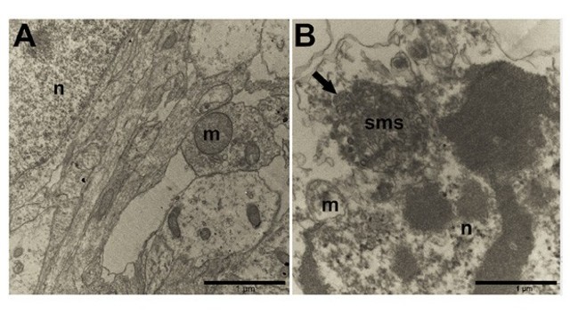 Experimento flagra zika atacando neurônios pela primeira vez
