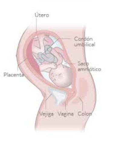 Treinta y Cuatro Semanas