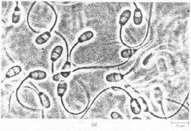 Anton Van Leeuwenhoek