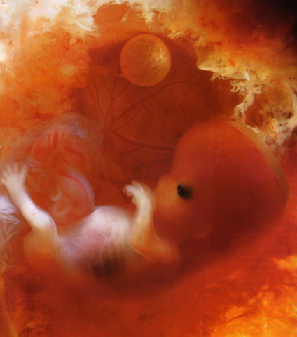 cuarto mes de embarazo