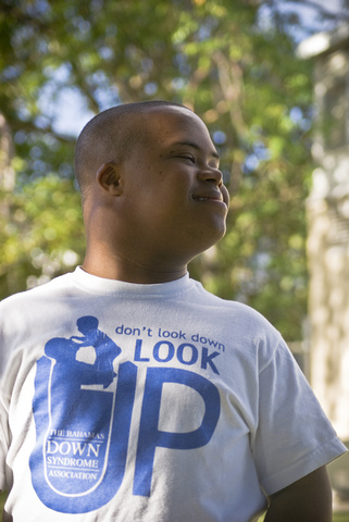 An additional copy of chromosome 21 linked to Down's syndrome