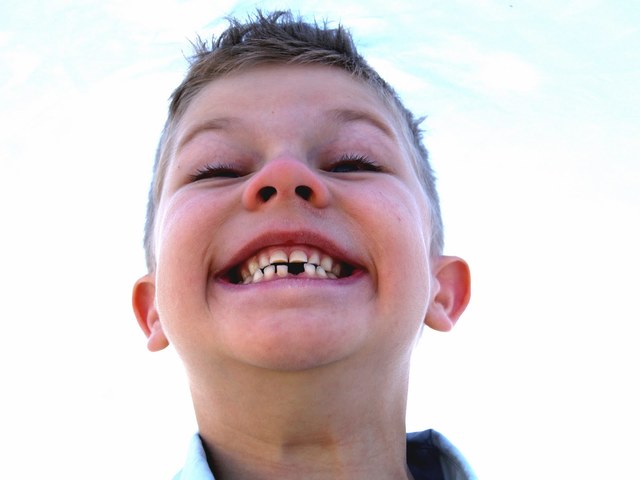 Lost my first tooth