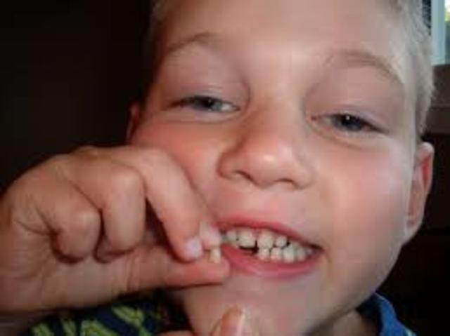 Lost My First Tooth