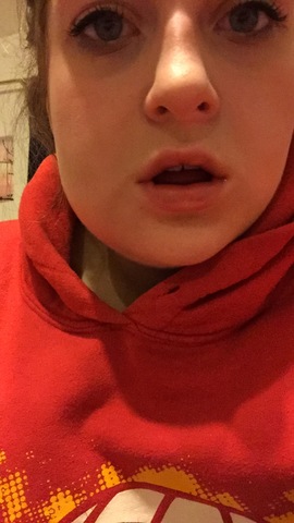 La dentista sacó mi muelas del juicio