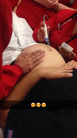 The teacher assisant in my medical class is pregnant!