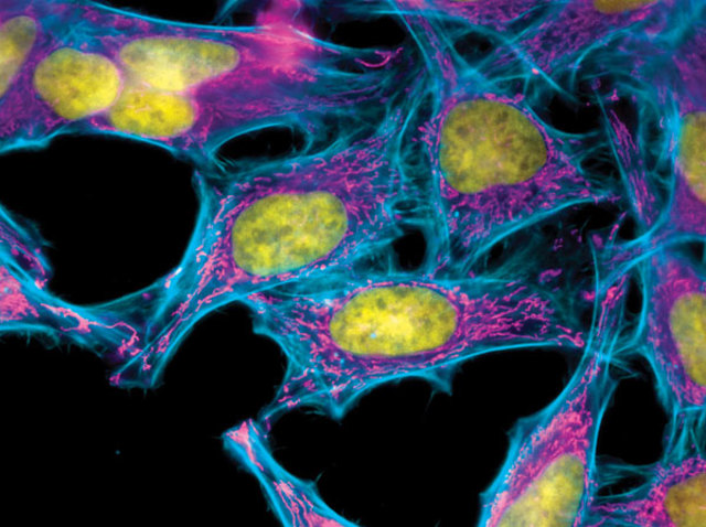 HeLa cells become the first cells ever cloned