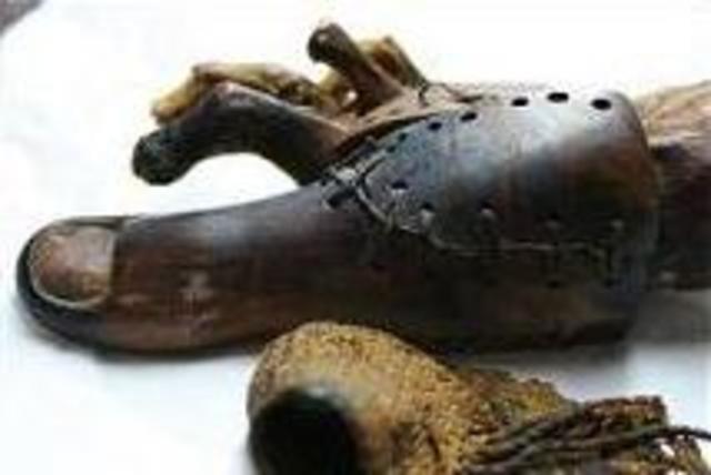 Primera prótesis enconrada