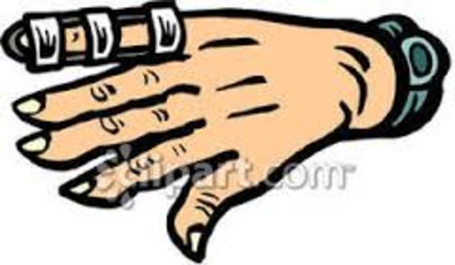 Breaking my Finger During a Soccer game