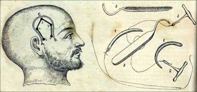 Enfermedades contagiosas